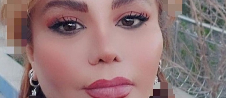 نتیجه نهایی تزریق چربی صورت