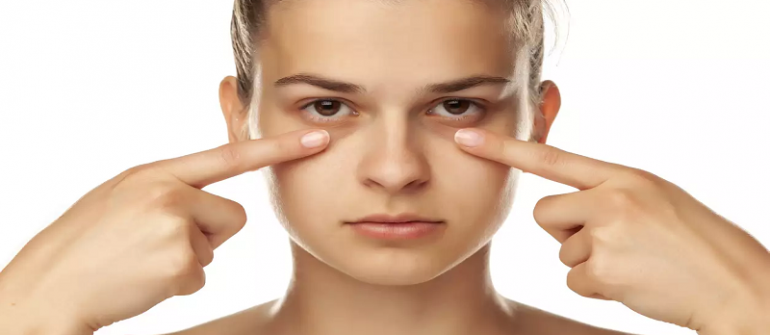 مزوتراپی دور چشم