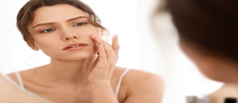 پوست چرب جوش میزند یا پوست خشک ؟