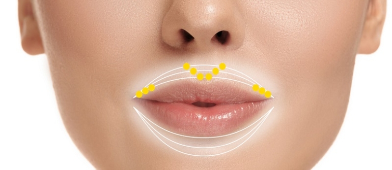 بوتاکس دور دهان : چگونه بدون تغییر حالت لب و صورت، خط را کنترل کنیم؟