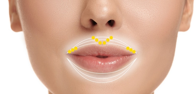 بوتاکس دور دهان : چگونه بدون تغییر حالت لب و صورت، خط را کنترل کنیم؟